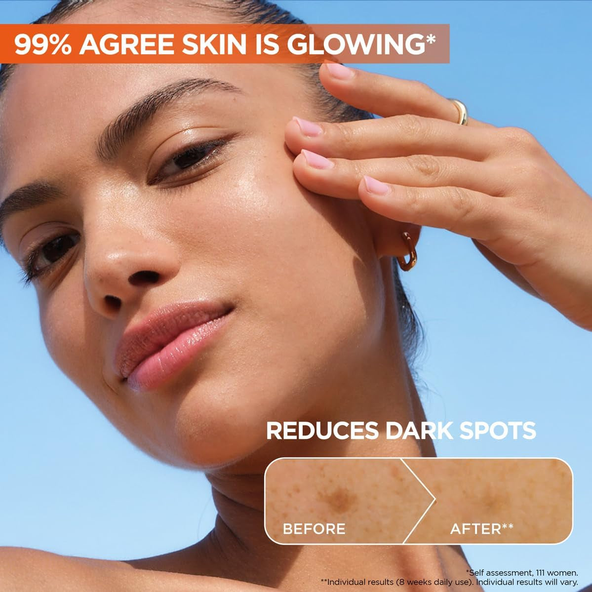 Skinactive Vitamin C Day Serum, Anti-Dark Spot and Brightening Face Serum for All Skin Types, 30 Ml
