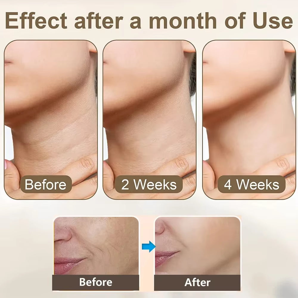 Facial Massager Neck Face Lifting Machine Anti-Aging Facial Massager Neck Face Lifting Device Anti-Wrinkle Double Chin Remover