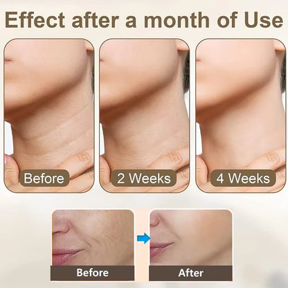 Facial Massager Neck Face Lifting Machine Anti-Aging Facial Massager Neck Face Lifting Device Anti-Wrinkle Double Chin Remover