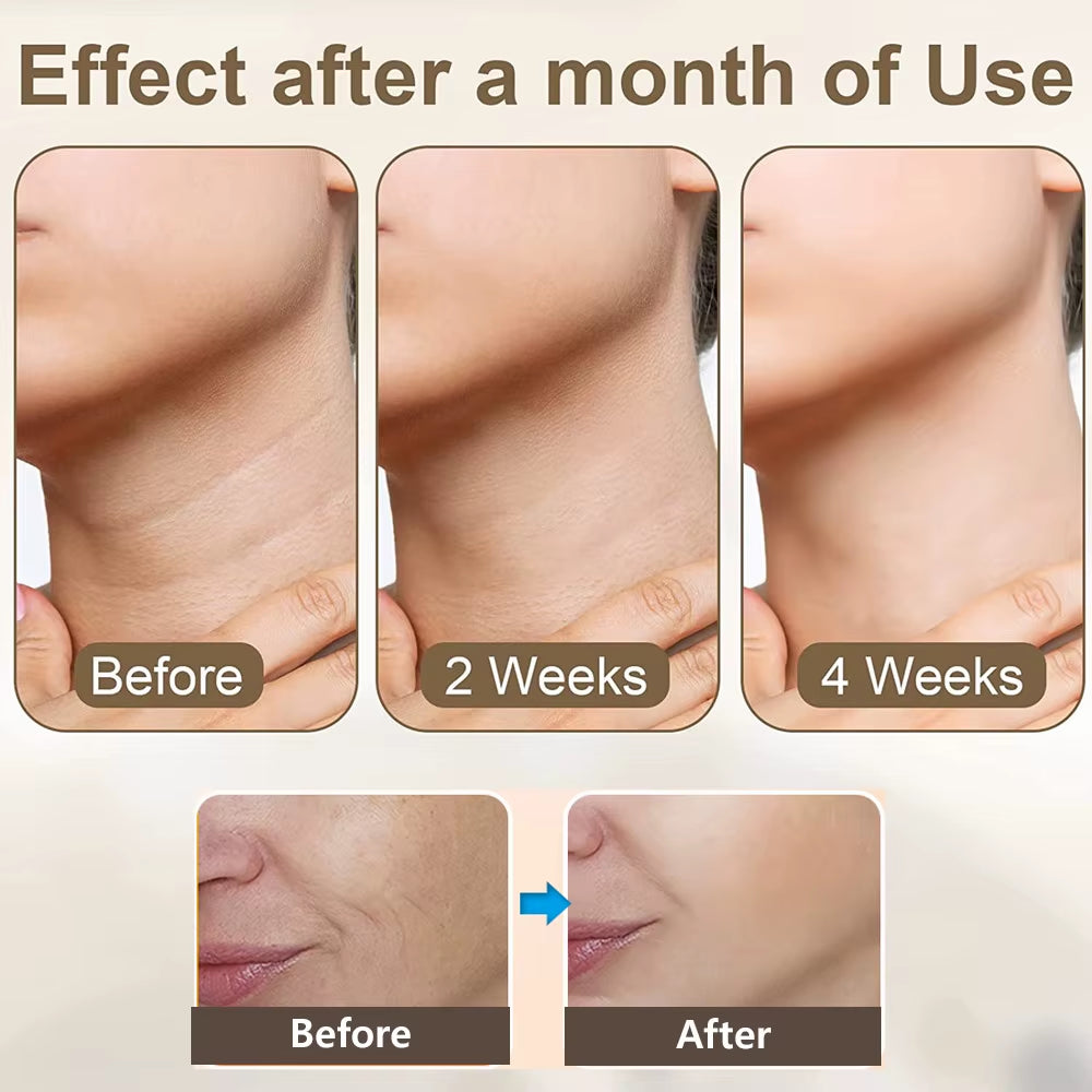 Facial Massager Face Neck Lifting Tighten Device Face Shaper Rejuvenation Thin Double Chin Vibrator Remove Neck Lines Massager