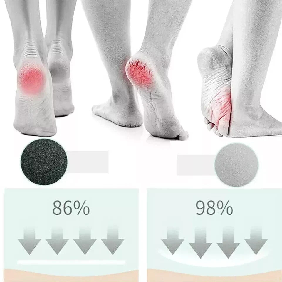 Electric Portable USB Foot Grinder File Vacuum Hard Skin Callus Remover Machine