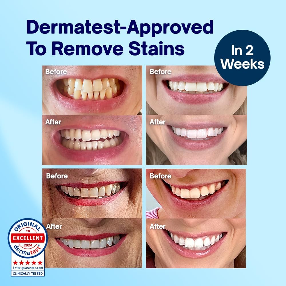 Dentist-Approved Teeth Whitening Powder - Indybest Award-Winner - Enamel-Safe & Sensitivity-Free - Cool Mint Flavour - Removes Years of Stains - 6 Month Teeth Whitener Supply