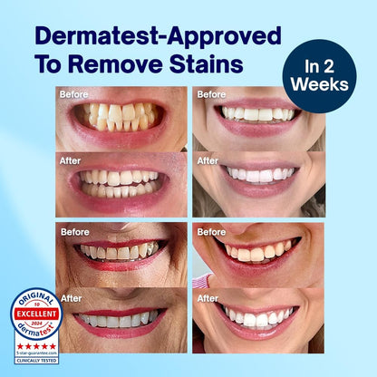 Dentist-Approved Teeth Whitening Powder - Indybest Award-Winner - Enamel-Safe & Sensitivity-Free - Cool Mint Flavour - Removes Years of Stains - 6 Month Teeth Whitener Supply