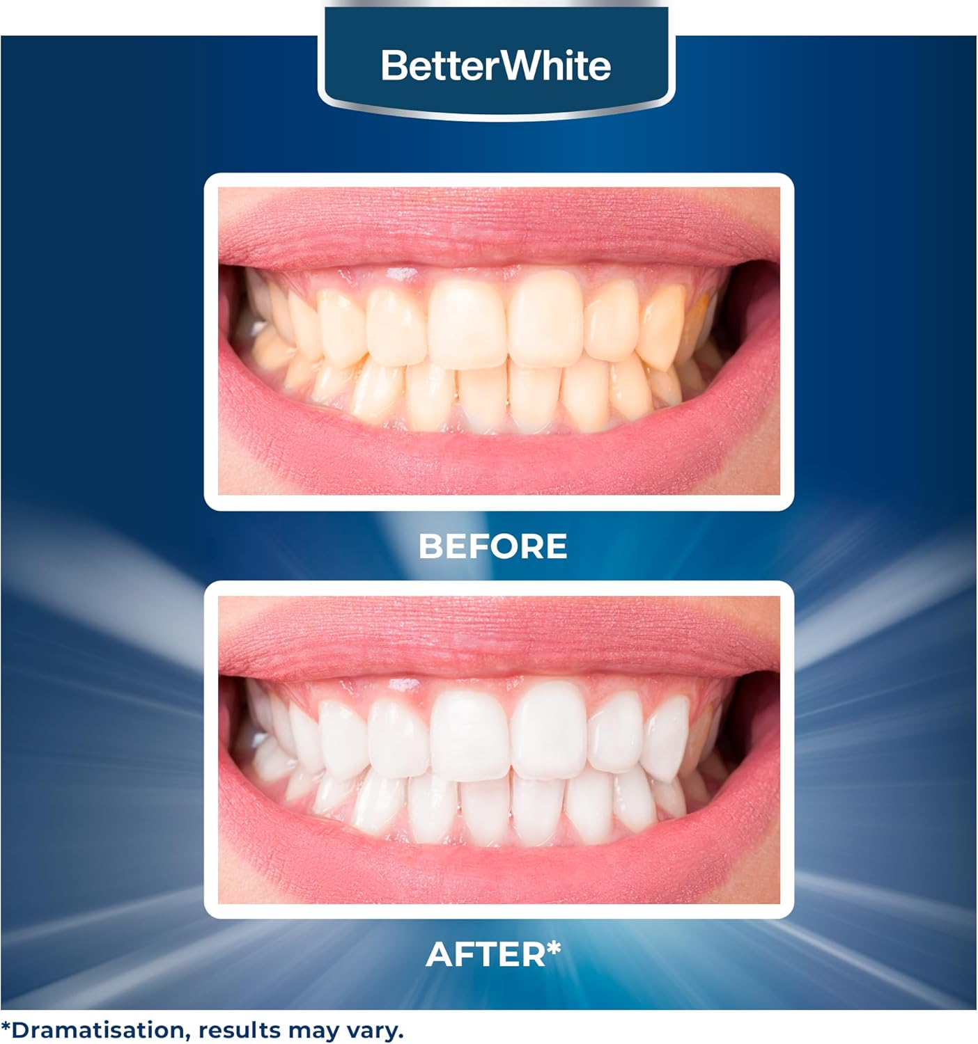 Teeth Whitening Powder - Dentist-Approved & Enamel-Safe | 6 Month Supply | Tea, Coffee, Wine & Smoking Stain Remover | Non-Sensitive Formula | Peroxide-Free | HAP, Baking Soda & Xylitol