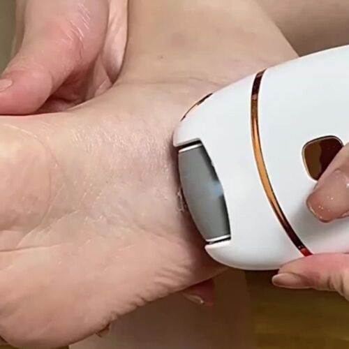 Electric Foot Grinder Vacuum Callus Remover Rechargeable Pedicure Machine Tool